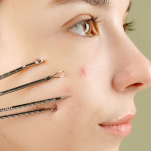 Facial Tratamiento Anti-Acné