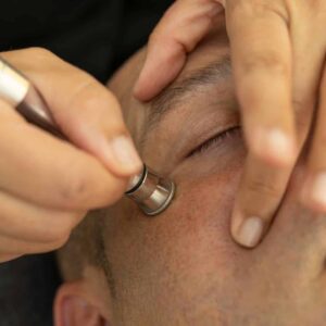 Facial Despigmentante con aparatología microdermoabrasión